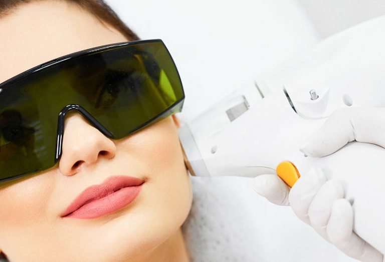 Apa Manfaat Laser Wajah Bagi Kulit?
