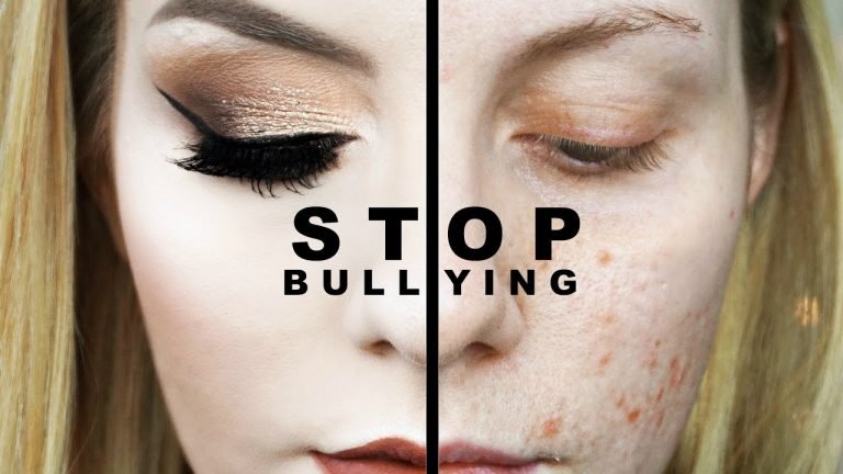 Beauty Bullying Marak di Medsos, Pelakunya Justru Perempuan
