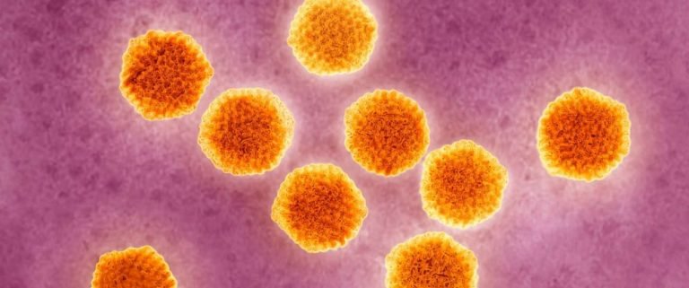 KLB Hepatitis A di Pacitan, Cincau dan Air Diduga Jadi Sumber Penularan